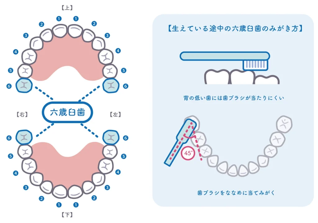 子ども　歯みがき　嫌がる　対処法