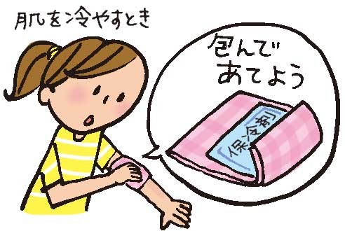 保冷材で肌を冷やすときは布で包んで当てよう